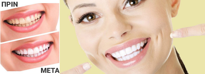 Συσκευή Λεύκανσης Δοντιών Luma Smile
